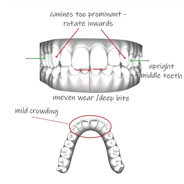 Smart People Do dental cleaning fees :)